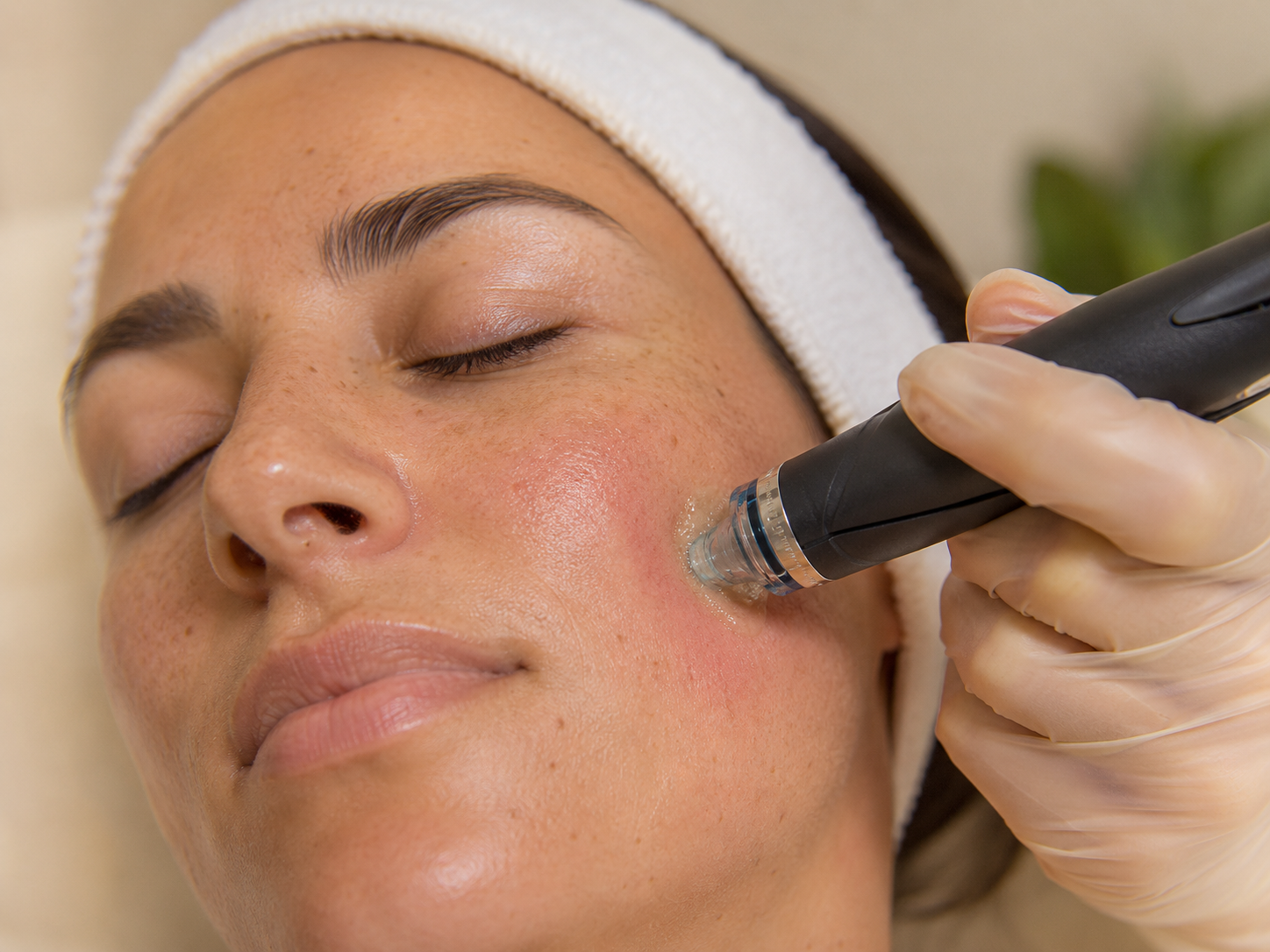 Hydrating Hydrafacial treatment